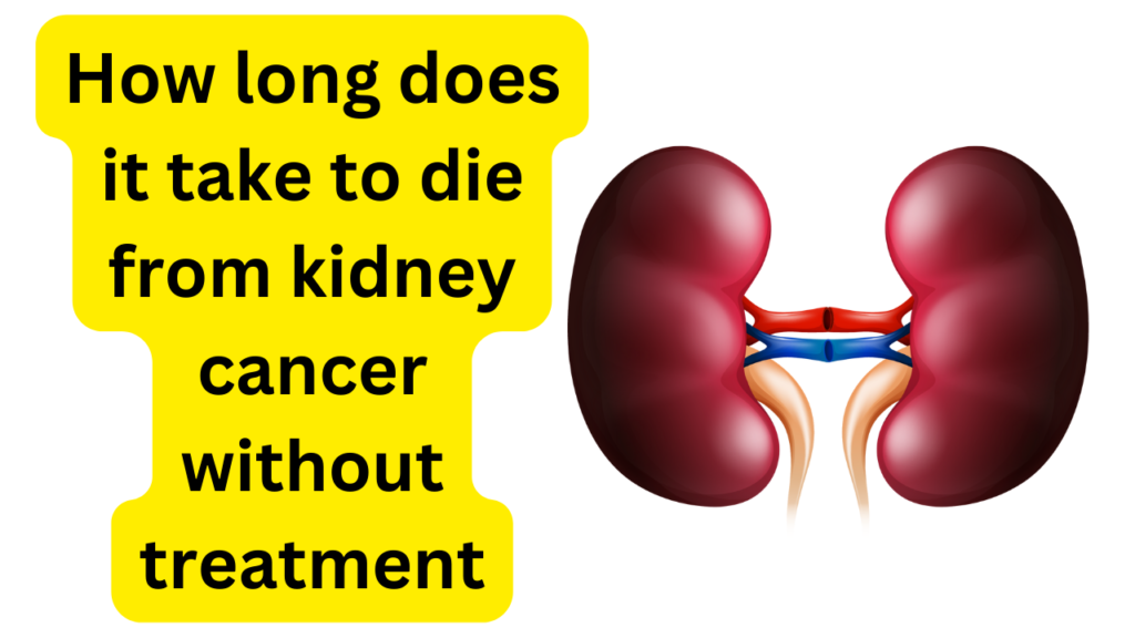 How long does it take to die from kidney cancer without treatment?